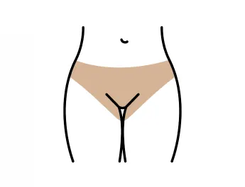 브라질리언 제모