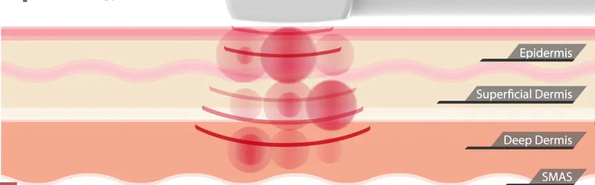 맞춤형 시술 디자인 참고 일러스트